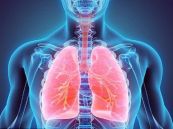 Nhiễm khuẩn gây viêm phổi thùy trên XQ và CT