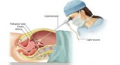 Nội soi và phẫu thuật nội soi ổ bụng: ý nghĩa lâm sàng giá trị kết quả
