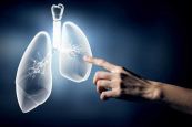 Sinh thiết phổi: ý nghĩa lâm sàng giá trị kết quả
