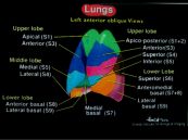 Xạ hình thông khí tưới máu phổi: ý nghĩa lâm sàng giá trị kết quả