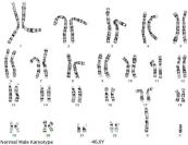 Xét nghiệm karyotype hay lập bộ nhiễm sắc thể: ý nghĩa lâm sàng chỉ số kết quả
