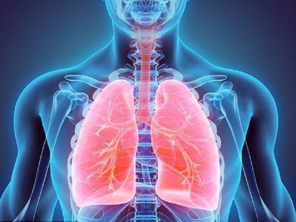 Hình ảnh viêm phổi thuỳ đỉnh phổi phải