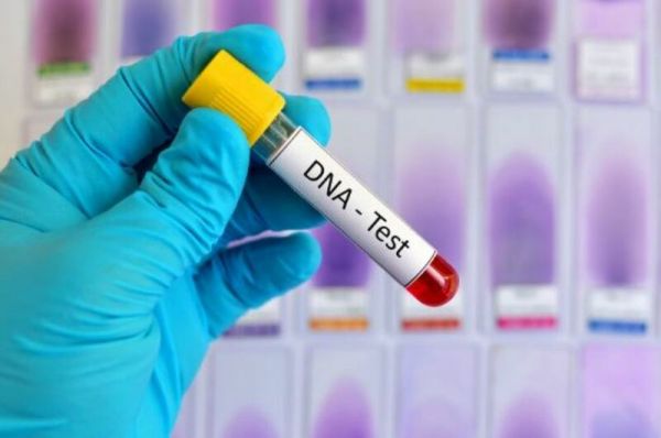 Thử nghiệm di truyền (kiểm tra DNA)