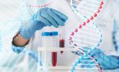Xét nghiệm gen Hemochromatosis (HFE Test): ý nghĩa lâm sàng kết quả xét nghiệm