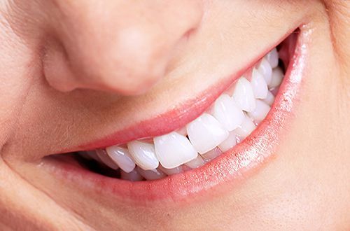 Tự kiểm tra mảng bám răng: ý nghĩa lâm sàng giá trị kết quả