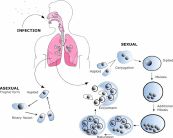 Bệnh viêm phổi do nhiễm trùng bào tử Pneumocystis - Triệu chứng, nguyên nhân và cách điều trị