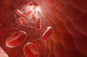 Bệnh đa hồng cầu nguyên phát - Triệu chứng, nguyên nhân và cách điều trị